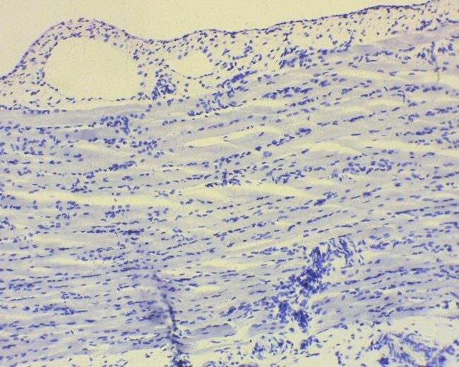 Видеоокуляр Микромед DCM-130E Видеоокуляр Микромед DCM-130E