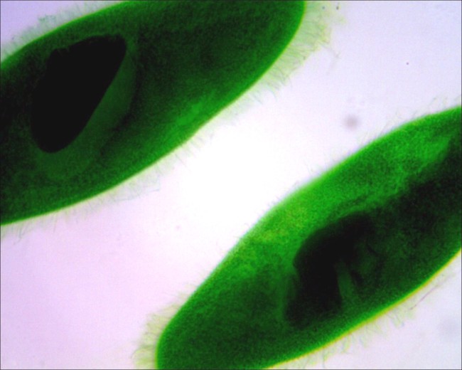 Видеоокуляр Микромед DCM-130E Видеоокуляр Микромед DCM-130E