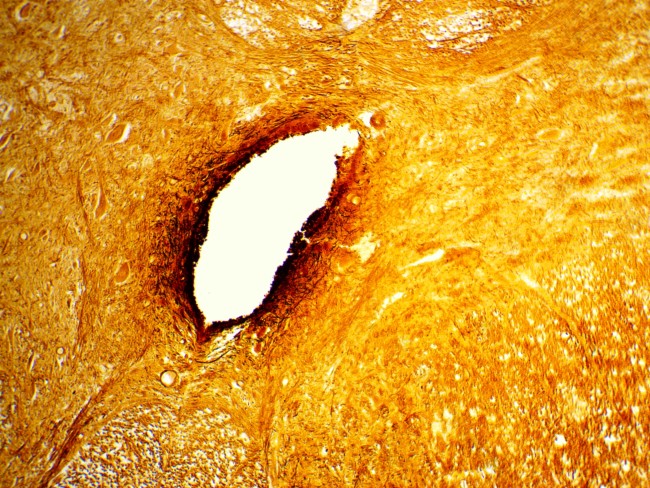 Видеоокуляр ToupCam UCMOS05100KPA